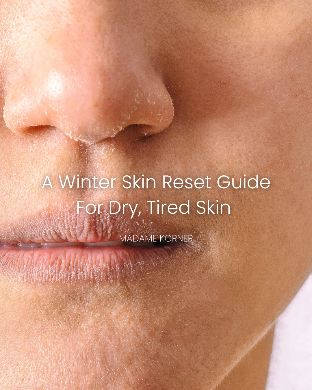 A Winter Skin Reset Guide For Dry, Tired Skin